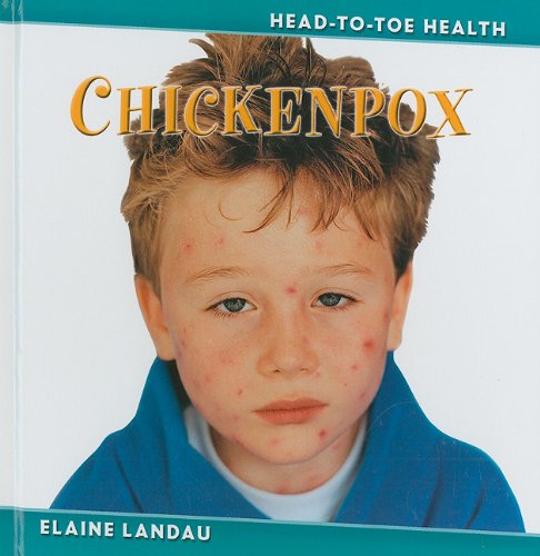 Chickenpox by Elaine Landau