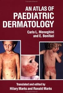 An Atlas of Paediatric Dermatology by Ernesto Bonifazi