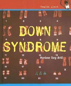 Down Syndrome (Health Aleart)