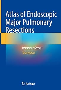Atlas of Endoscopic Major Pulmonary Resections by Dominique Gossot