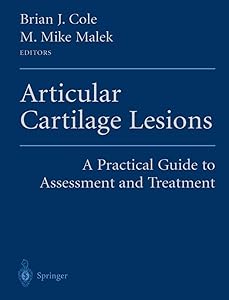 Articular Cartilage Lesions: A Practical Guide to Assessment and Treatment by Brian J. Cole