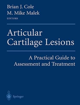 Articular Cartilage Lesions: A Practical Guide to Assessment and Treatment