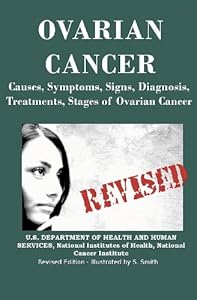 Ovarian Cancer: Causes, Symptoms, Signs, Diagnosis, Treatments, Stages of Ovarian Cancer