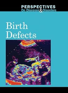 Birth Defects (Perspectives on Diseases & Disorders)