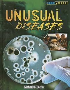 Unusual diseases
