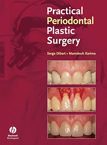 Acute Pain and Management: Operative or Medical Procedures and Trauma