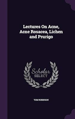 Lectures On Acne, Acne Rosacea, Lichen and Prurigo