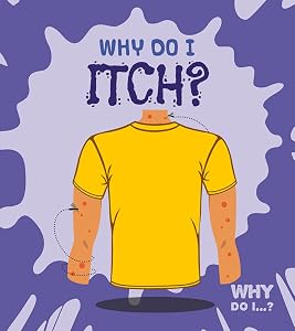 Why Do I Itch?