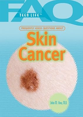 Frequently Asked Questions about Skin Cancer