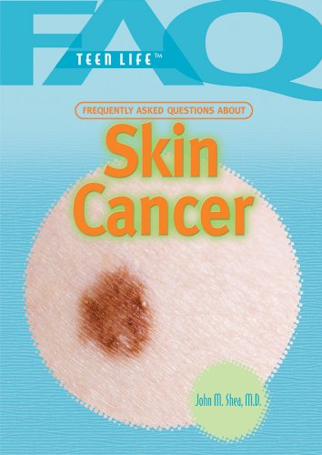 Frequently Asked Questions about Skin Cancer by John M Shea