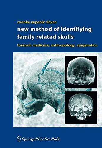 New Method of Identifying Family Related Skulls: Forensic Medicine, Anthropology, Epigenetics by Zvonka Zupanic Slavec