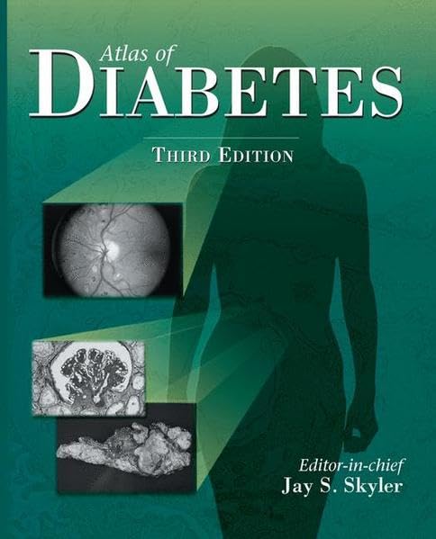 Atlas of Diabetes by Sebastian Thrun