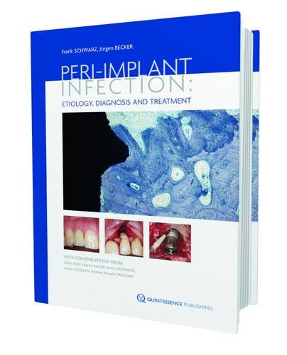 Mammography for Radiologic Technologists
