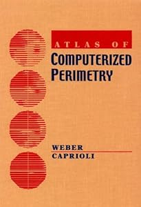Atlas of Computerized Perimetry by Jorg Weber MD