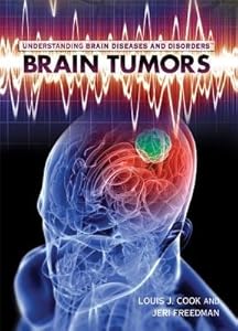 Brain Tumors (Understanding Brain Diseases and Disorders)