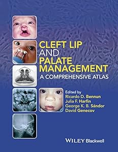 Cleft Lip and Palate Management: A Comprehensive Atlas by George K. B. S&aacute;ndor