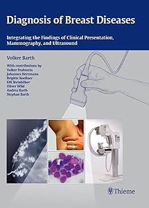 Diagnosis of Breast Diseases: Integrating the Findings of Clinical Presentation, Mammography, and Ultrasound by Volker Barth