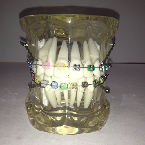 Dentalmall® 1 Pc New Dental Model #3005 02 - Orthodontics Treatment Model