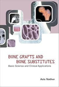 BONE GRAFTS AND BONE SUBSTITUTES: BASIC SCIENCE AND CLINICAL APPLICATIONS by Abdul Aziz Nather