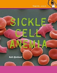 Sickle Cell Anemia (Health Alert)