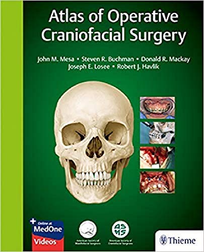Algopix Similar Product 18 - Atlas of Operative Craniofacial Surgery