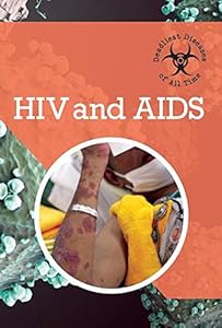 HIV and AIDS