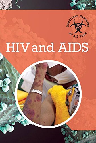HIV and AIDS by Randall McPartland