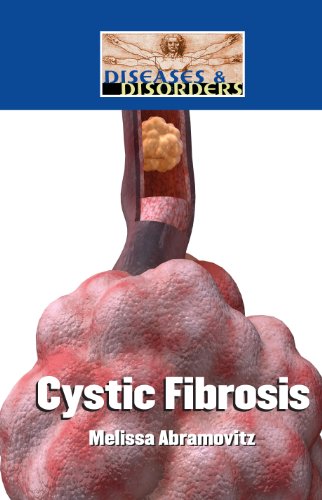 Cystic fibrosis by Melissa Abramovitz