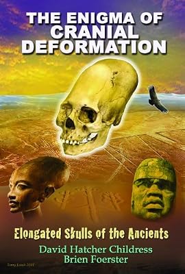 The Enigma of Cranial Deformation: Elongated Skulls of the Ancients
