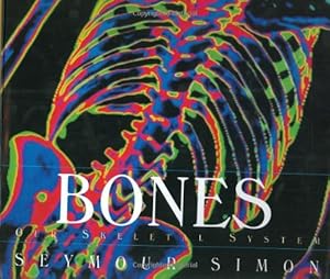Bones: Our Skeletal System (Human Body)