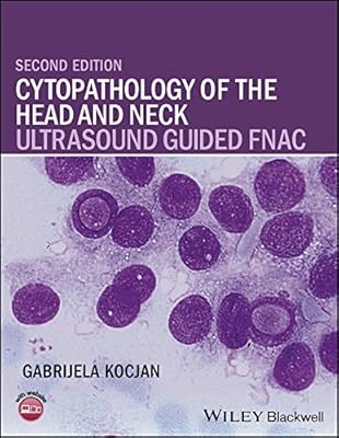 Cytopathology of the Head and Neck: Ultrasound Guided FNAC