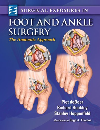 Algopix Similar Product 7 - Surgical Exposures in Foot  Ankle