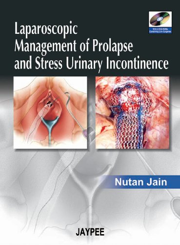 Algopix Similar Product 6 - Laparoscopic Management of Prolapse and