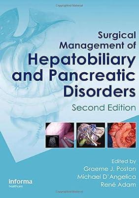 Surgical management of hepatobiliary and pancreatic disorders, 2d ed.