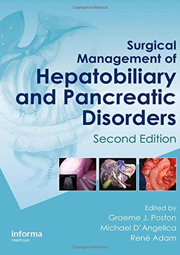 Surgical management of hepatobiliary and pancreatic disorders, 2d ed. by poston