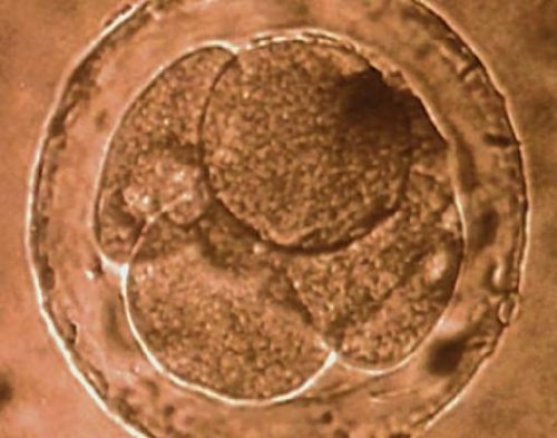 Ein Leben entsteht - Zeugung, Entwicklung, Geburt - DVD - Lehrfilm für Unterricht und Ausbildung - Hagemann 180234 - Einzellizenz - 