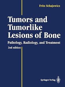 Tumors and Tumorlike Lesions of Bone: Pathology, Radiology, and Treatment by Fritz Schajowicz