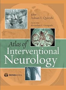 Atlas of Interventional Neurology by Adnan I. Qureshi MD