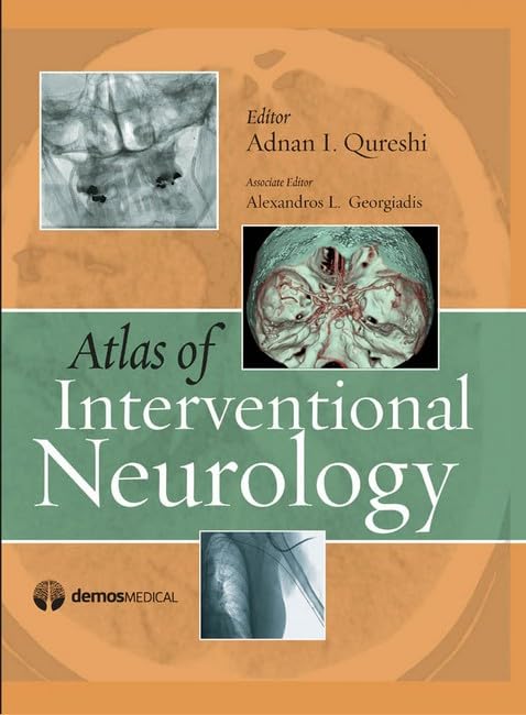 Atlas of Interventional Neurology by Adnan I. Qureshi MD