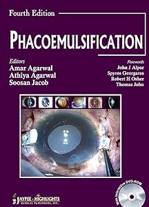 Phacoemulisification by Amar Agarwal