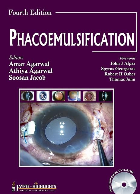 Phacoemulisification by Amar Agarwal