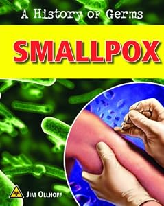 Smallpox
