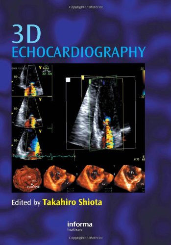 3D Echocardiography by Takahiro Shiota