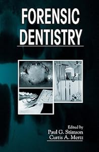 Forensic Dentistry by Paul G. Stimson