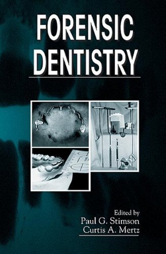 Forensic Dentistry by Paul G. Stimson