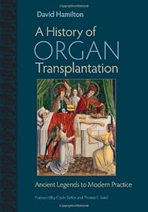 A History of Organ Transplantation: Ancient Legends to Modern Practice