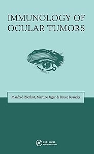 Immunology of Ocular Tumors by M. Jager
