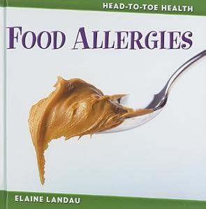 Food Allergies