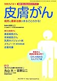 皮膚がん 2015年 09 月号 [雑誌]: がんサポート 別冊