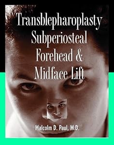 Transblepharoplasty subperiosteal forehead & midface lift by Malcolm D Paul